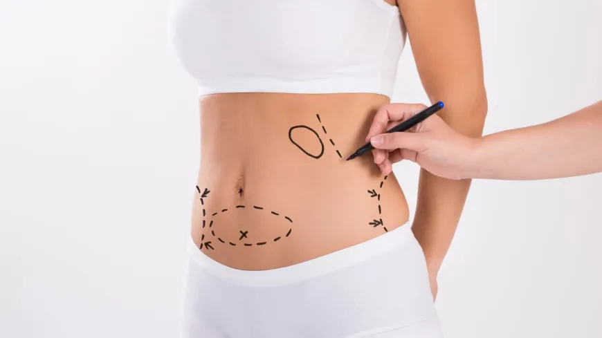 Dubai Liposuction Surgery: The Beginner’s Guide