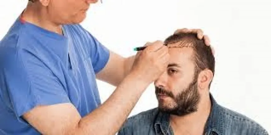 Key Factors Impacting Hair Transplant Pricing in Riyadh