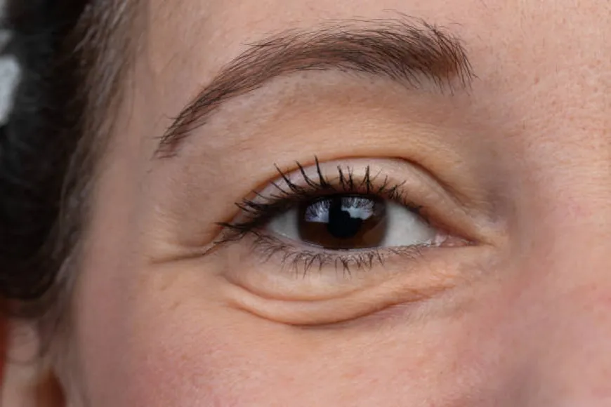 Revitalize Your Eyes with Under Eye Fillers Today