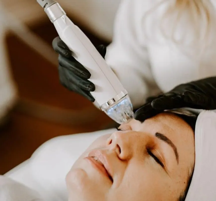 A Beginner's Guide to Understanding Fractional RF Microneedling Benefits