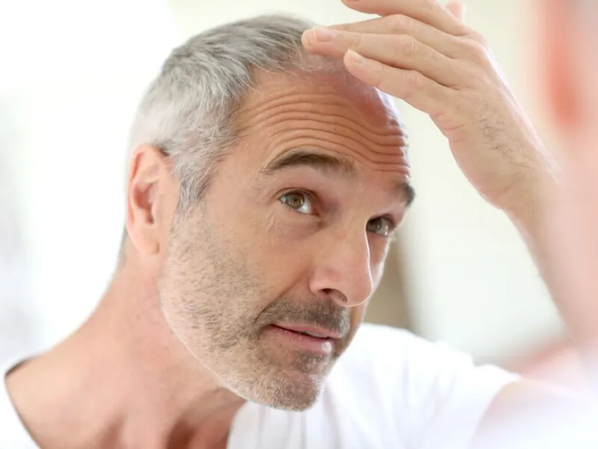 Post-Operative Care: How to Ensure the Best Results After Hair Transplant