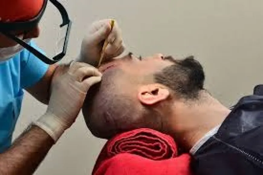 Your Hair Restoration Journey in Riyadh: Start to Finish