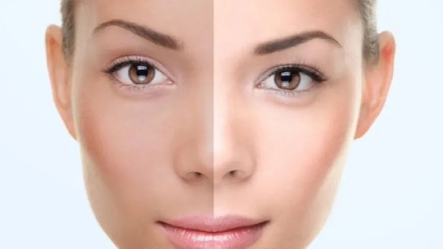 Understanding Permanent Skin Whitening Procedures in Dubai