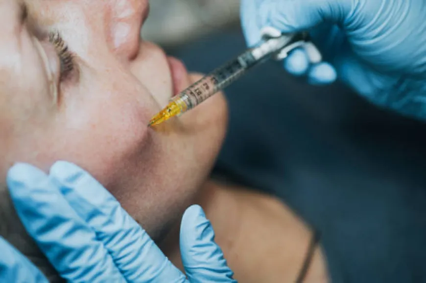 How Cheek fillers injections Can Transform Your Smile