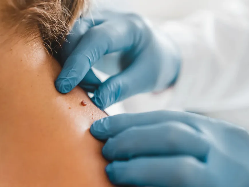 Exploring Different Approaches to Skin Tag Removal