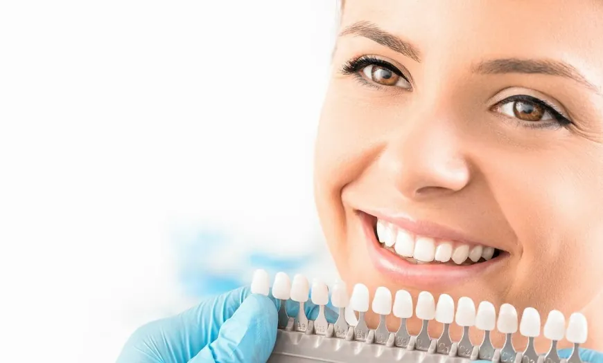 Unveiling a Brighter You: Research on Teeth Whitening in Mississauga