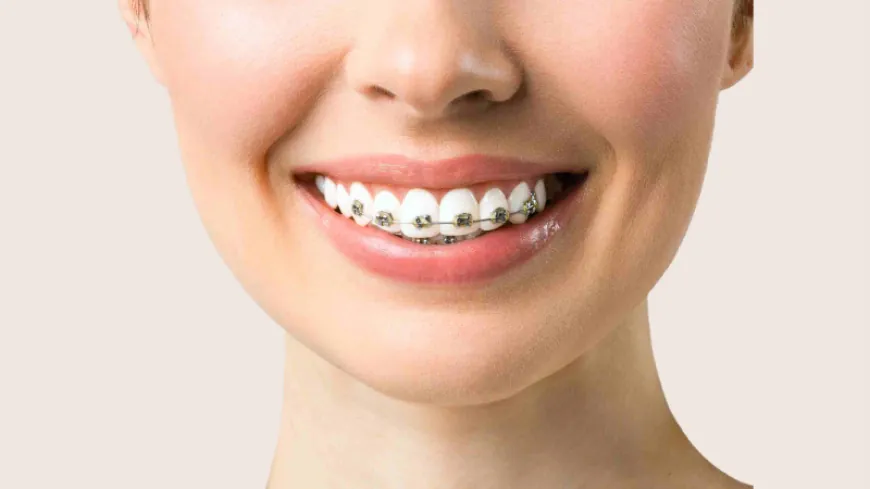 Caring for Your Braces: Essential Tips for Dubai Residents