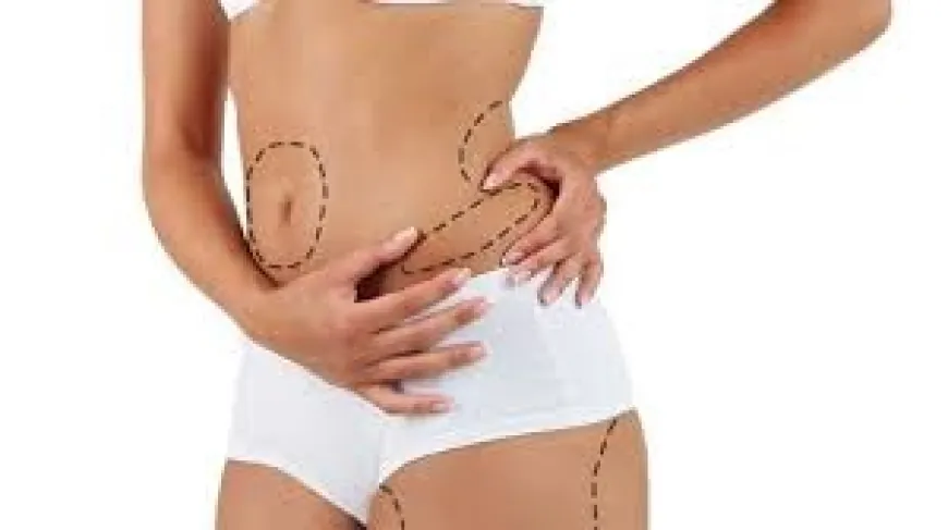 Shape Your Body, Embrace Your Confidence with Liposuction in Dubai