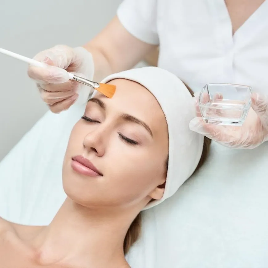 Chemical Peels for Acne: A Comprehensive Guide