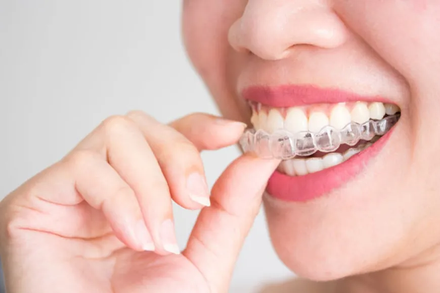 Understanding  Invisalign Braces Treatment Cost in Dubai: A Complete Guide