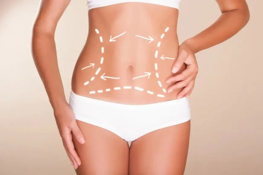 Minimally Invasive Body Sculpting: The Liposuction Advantage