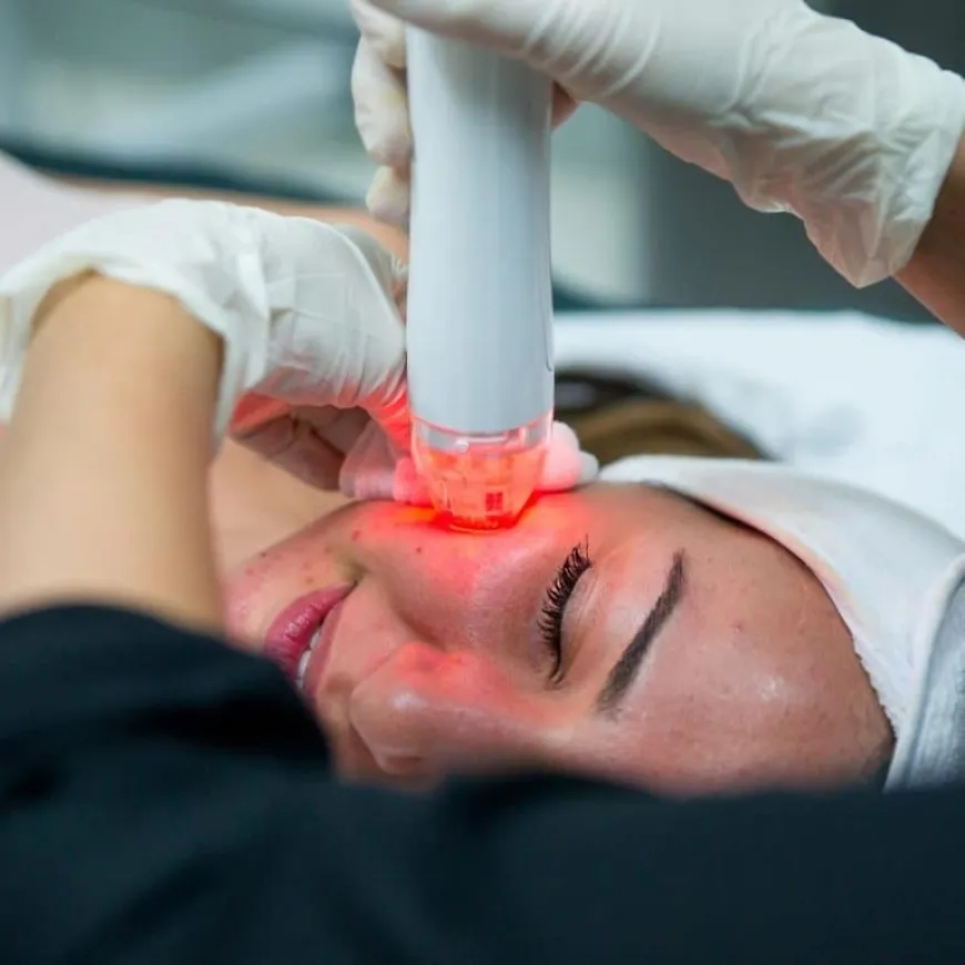 Assessing Your Skin Type for Fractional RF Microneedling in Dubai