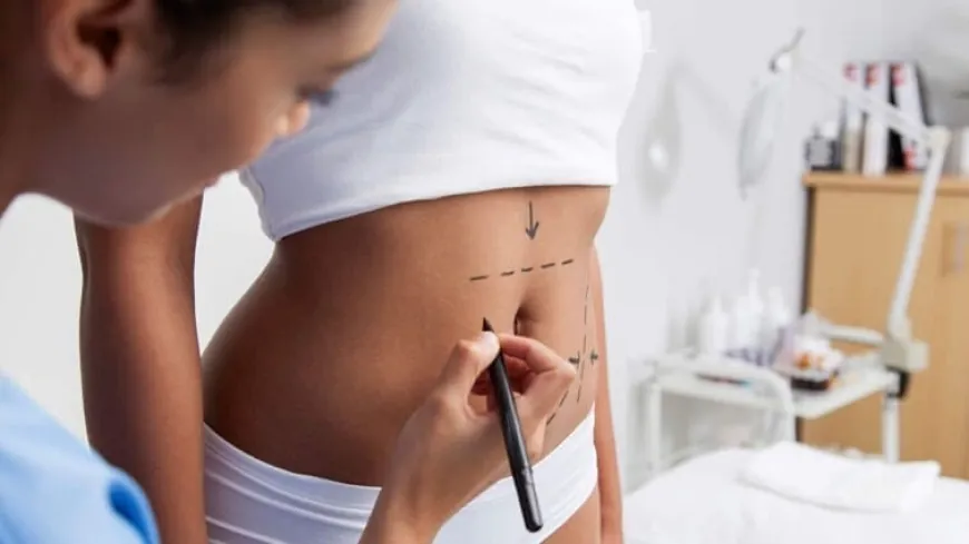 Navigating the Tummy Tuck Journey  Insights for Dubai Patients