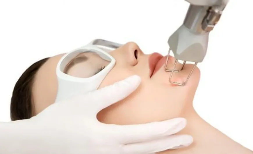 The Fractional CO2 Laser Treatment Procedure