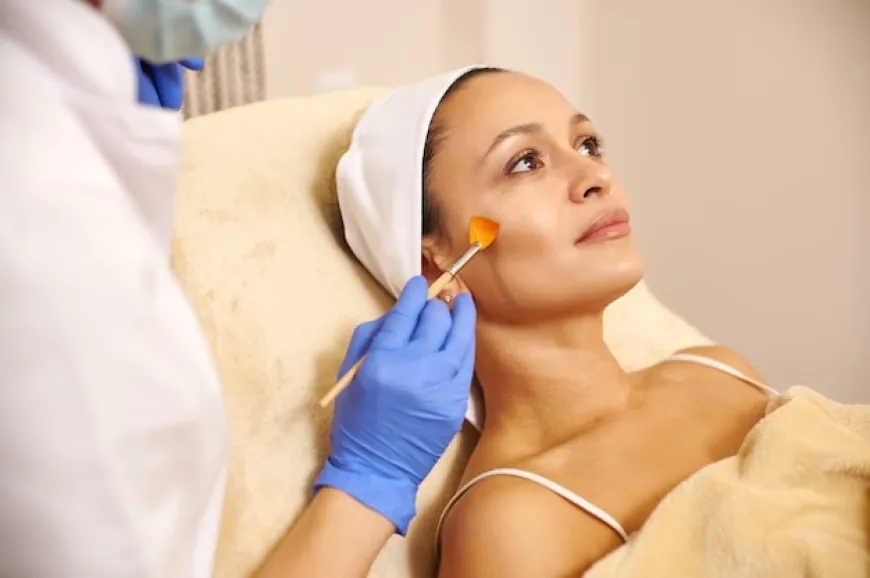 Uncover Radiant Skin: Chemical Peels Await You