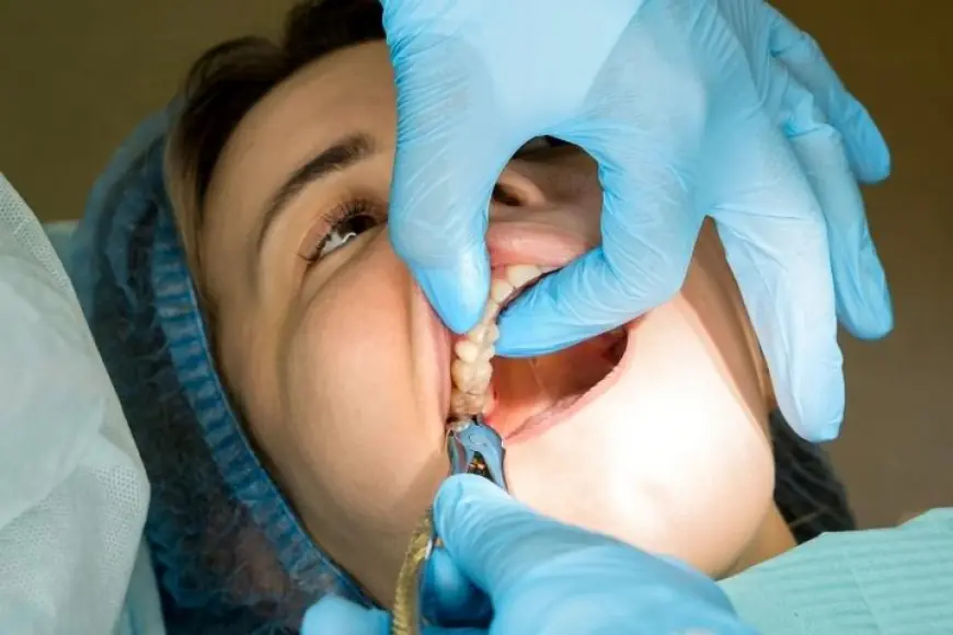 From Consultation to Aftercare: Navigating Your Tooth Removal Journey