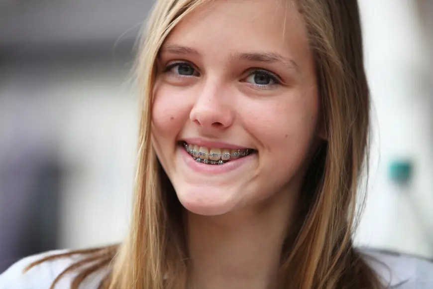 Retainers for Teens: A Parent's Guide to Post-Braces Care