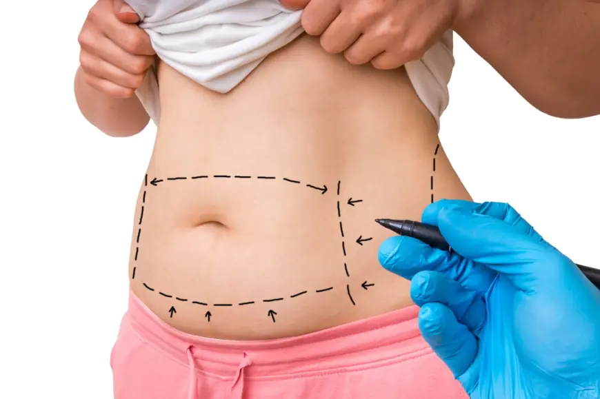 Patient Testimonials: Why the Best Doctors in Dubai Are Trusted for Tummy Tuck