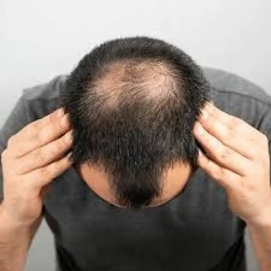 Confidence Restored: Hair Transplants in Dubai That Work