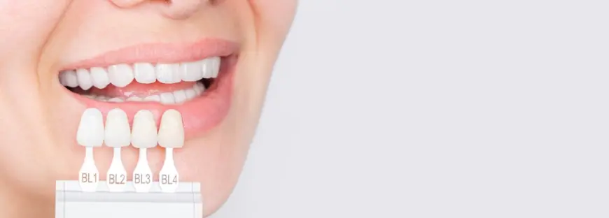 Dental Veneers for a Confident You