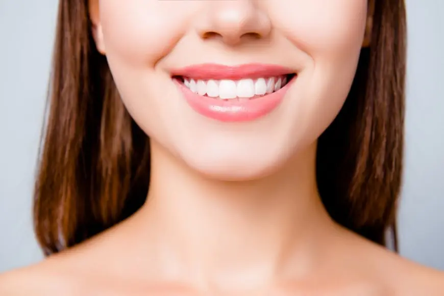 Is Teeth Whitening Safe? Debunking Common Myths and Misconceptions