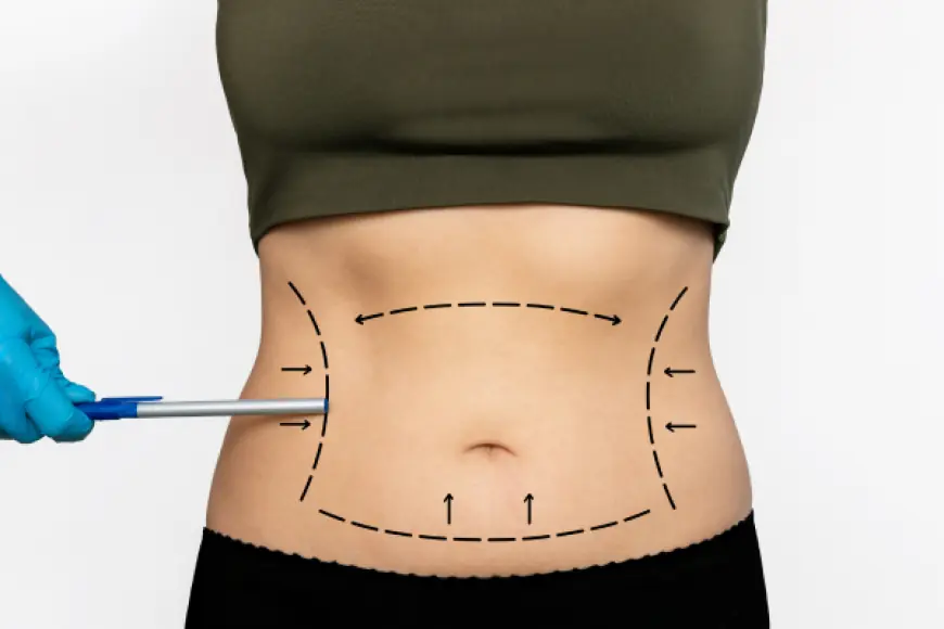 10 Ideas for Enhancing Liposuction in Dubai