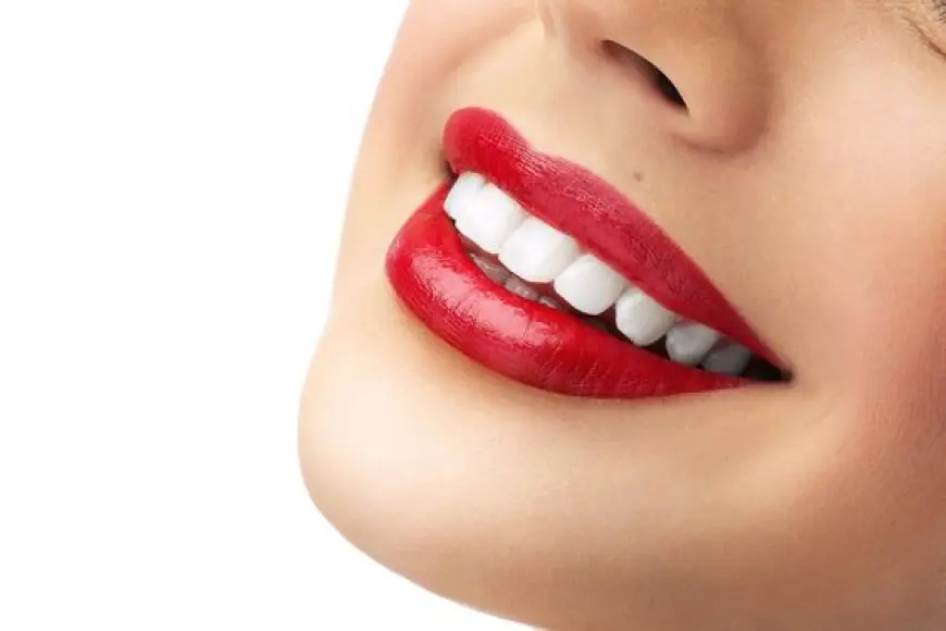 Can Teeth Whitening in Silicon Oasis Fix Yellowing Teeth?