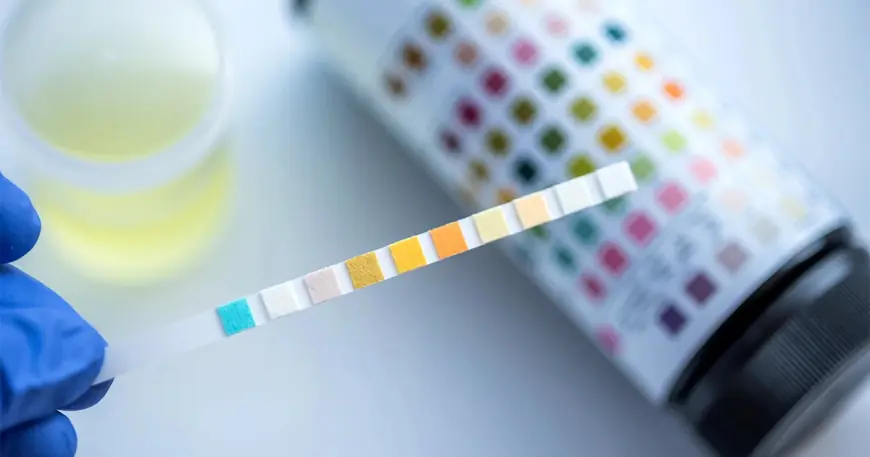 The Benefits of Choosing a Home Drug Test Kit