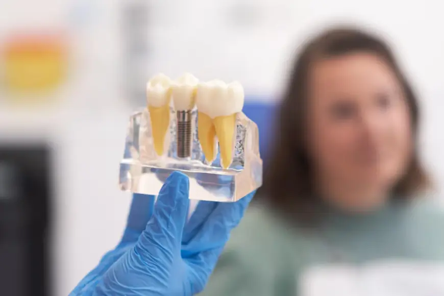 Same-Day Dental Implants: A Quick and Convenient Solution