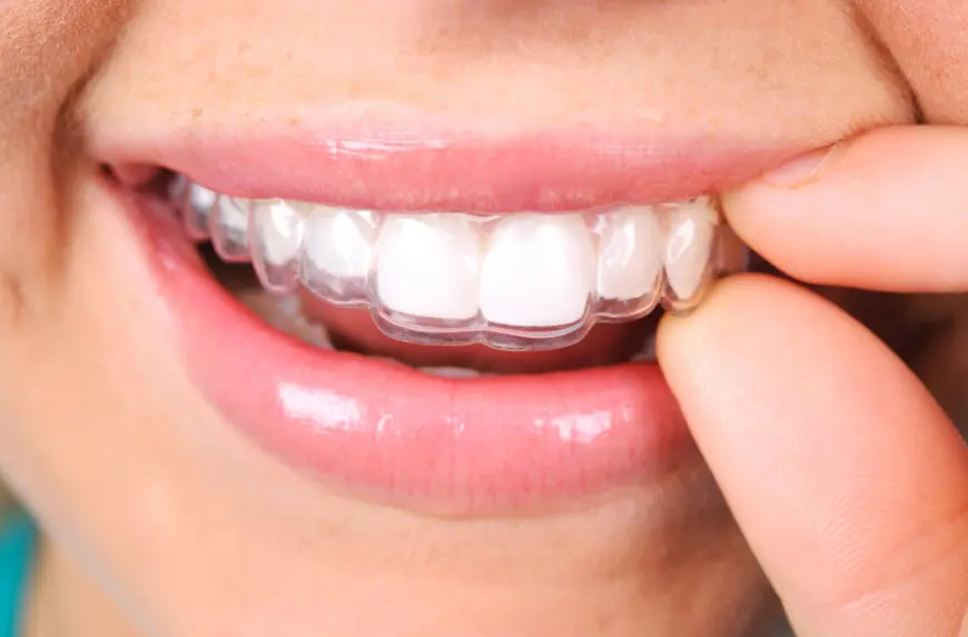 Clear Aligner Solutions: How Invisalign Treatment in Boise Can Straighten Your Smile