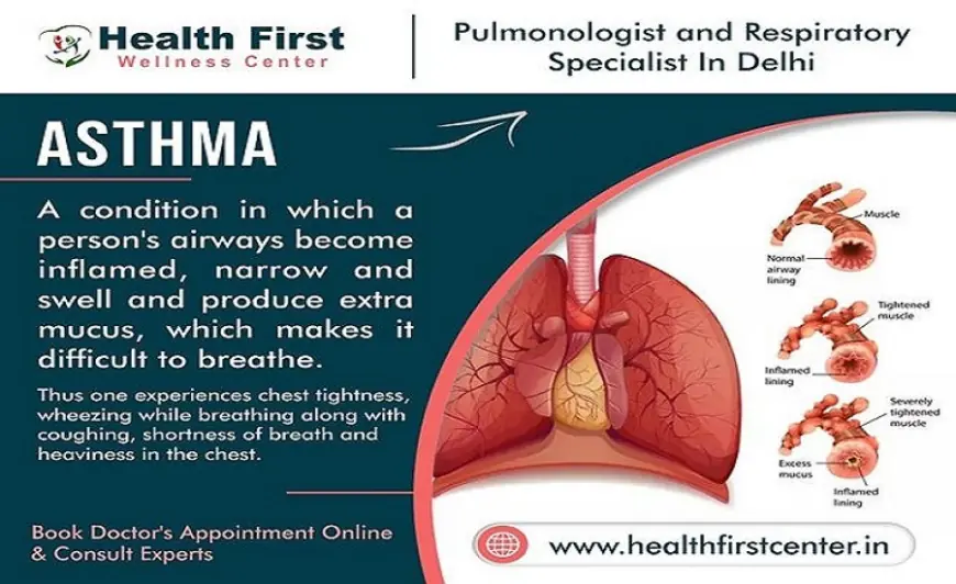 Searching for an Asthma Doctor Near Me? Dr. Sanchayan Roy is the Best Choice