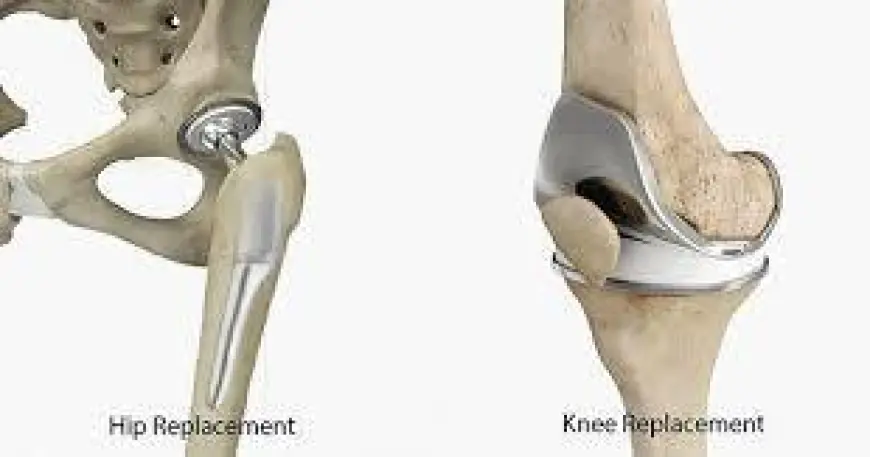 Top Reasons to Choose Dr. Shohab Hyder for Hip and Knee Surgery in Karachi