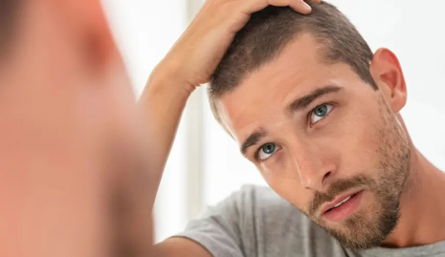 Understanding Alopecia: When a Hair Transplant May Help