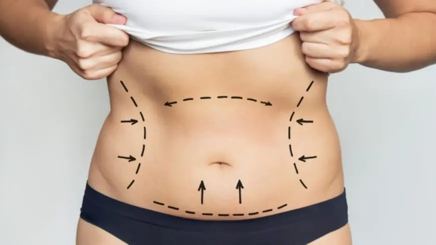 Common Concerns About Full Body Liposuction Tips From Best Doctors in Dubai