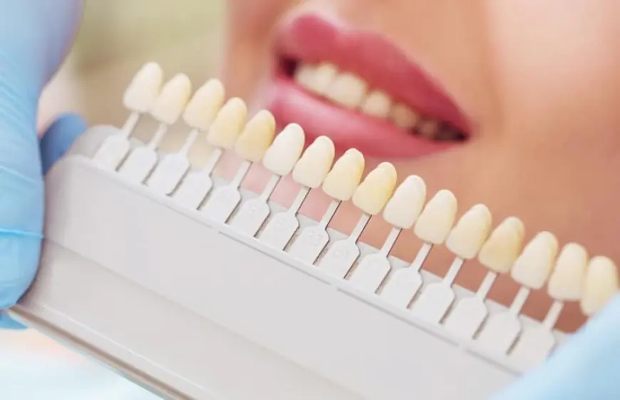 Navigating the Cost of Dental Veneers in Dubai: What You Should Expect