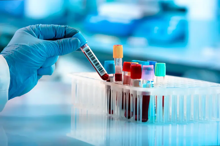 Rare Biological Sample Collection Market Analysis, Size, Share, Growth, Trends, and Forecasts by 2031