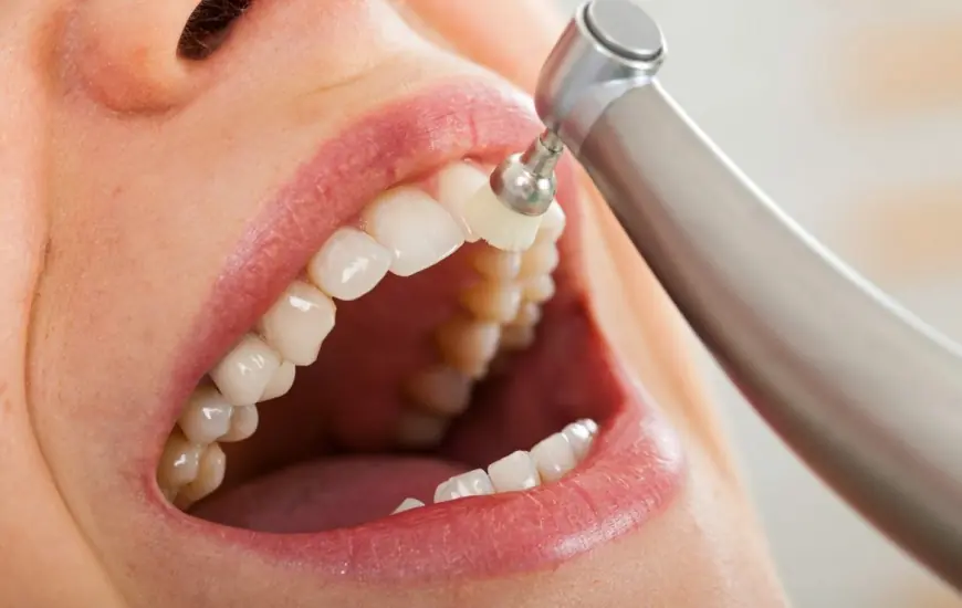 Teeth Cleaning for Athletes: Keeping Your Smile in Shape