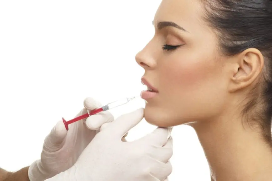 The Beauty of Lip Fillers: Enhancing Your Lips Without Surgery