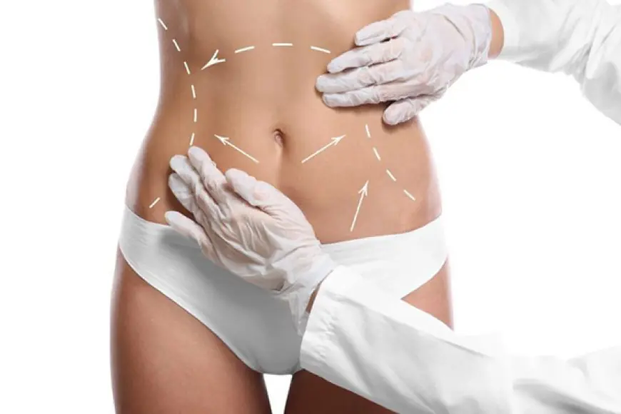 A Comprehensive Guide to Tummy Tuck Surgery in Dubai