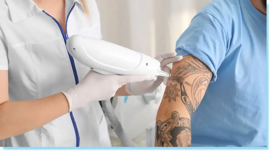 Regain Your Confidence, One Tattoo Removal in Dubai Laser Session at a Time