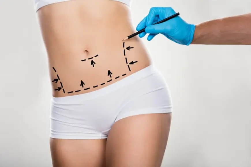 Exploring the Benefits of Tummy Tuck Procedures in Dubai