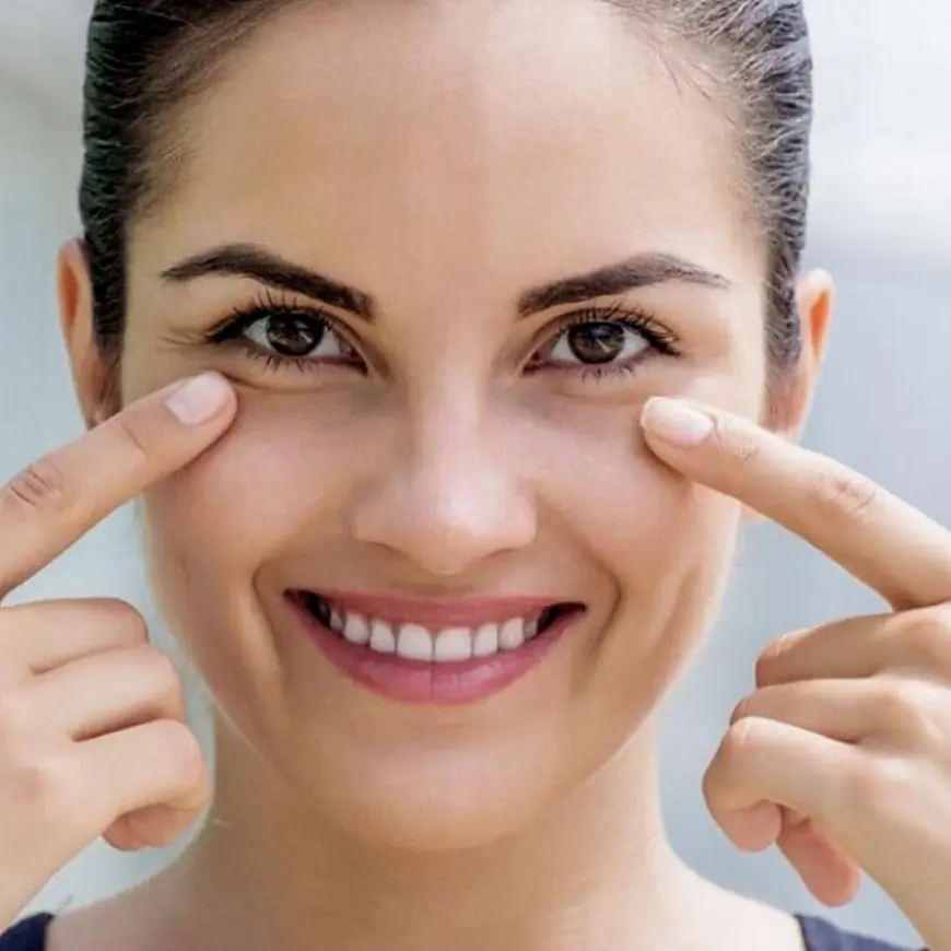 Laser Treatments for Dark Circles: A Comprehensive Guide