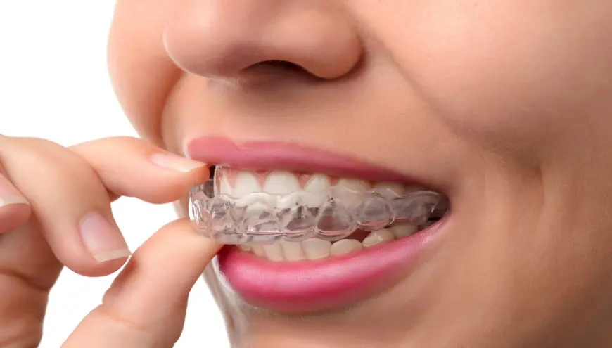 Do invisible aligners work?