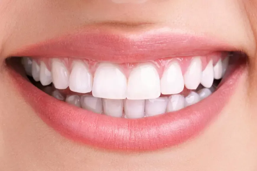 How Teeth Whitening Helps With Oral Health Beyond Appearance?