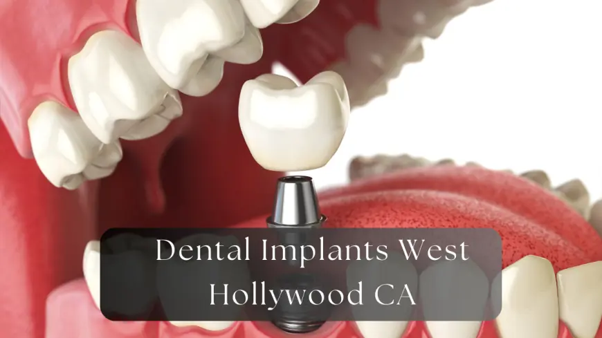 10 Foods to Avoid After Getting Dental Implants in West Hollywood