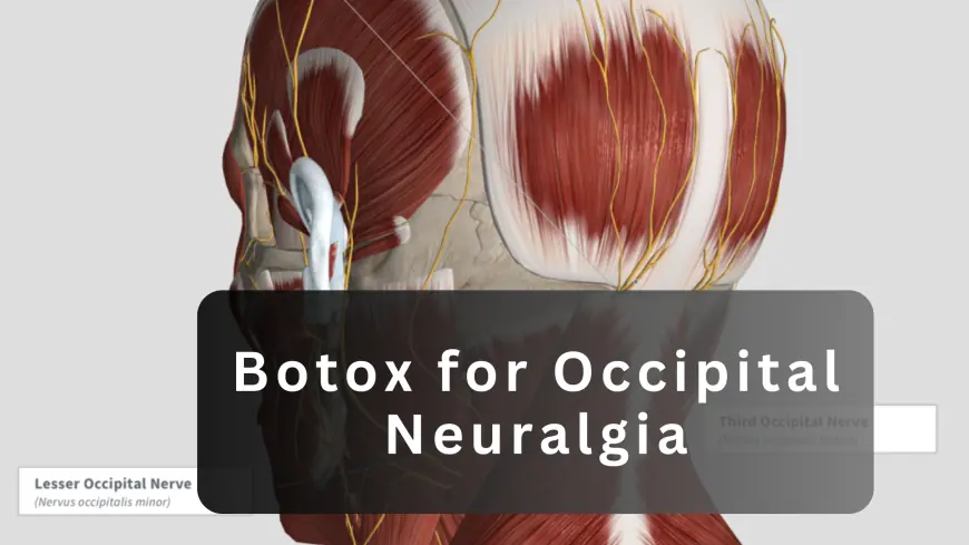 Comparing Botox and Traditional Treatments for Occipital Neuralgia