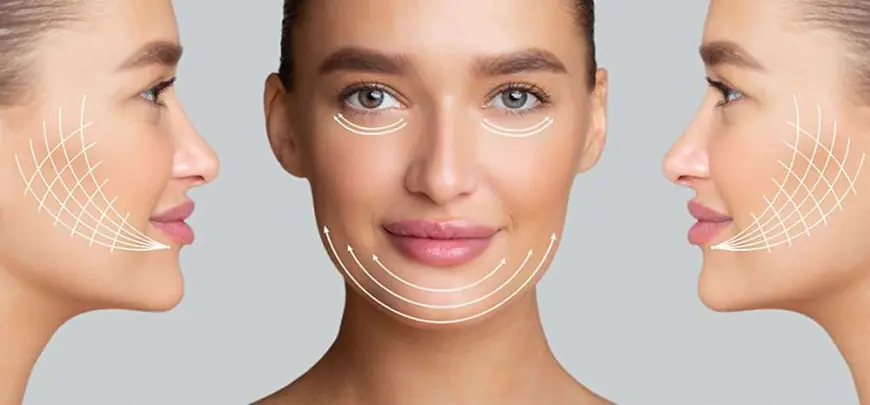 How Thread Lift Treatment Targets Fine Lines