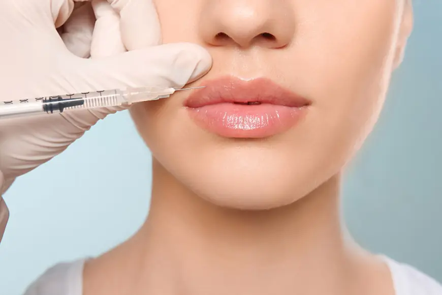 How Long Do Lip Fillers Injections Last on Average?