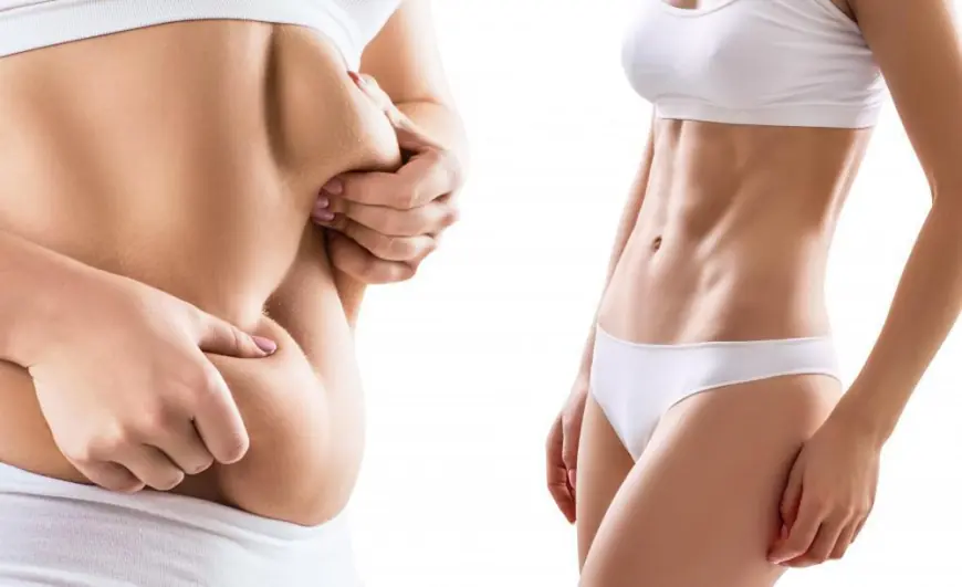 Link Between Body Image and Liposuction Insights From Best Liposuction Surgeons in Dubai