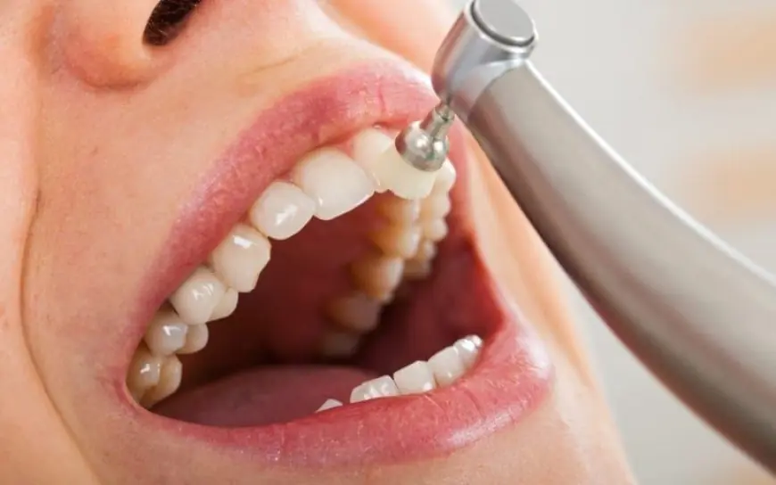 The Real Costs of Getting a Tooth Filling Explained